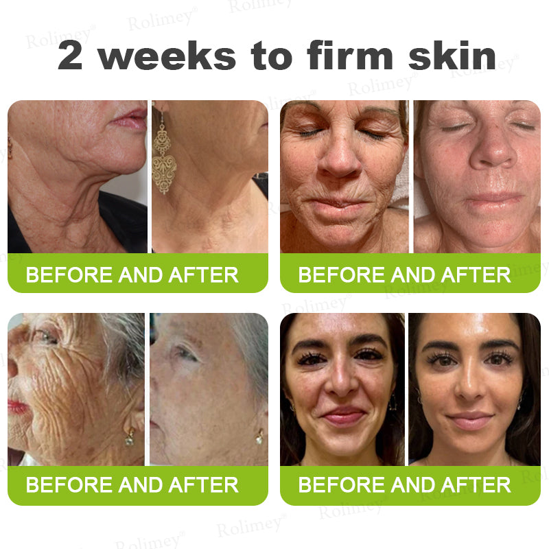 Buy 4 Get 2 Free(6 tubes⏰Flash Sale)&Free Shipping