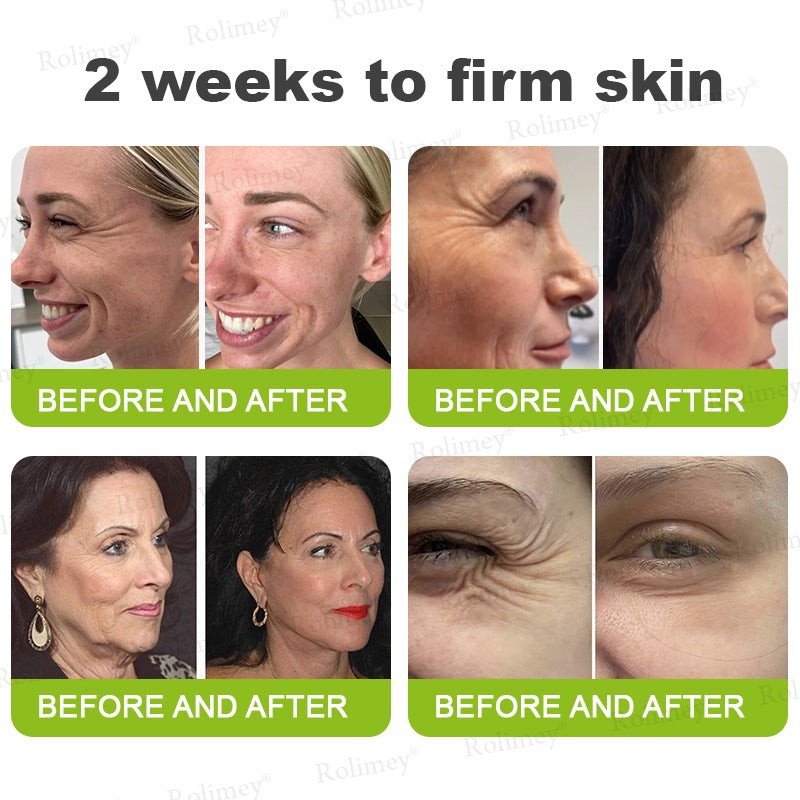 💥Buy 5 Get 3 Free - Deep Anti-Aging