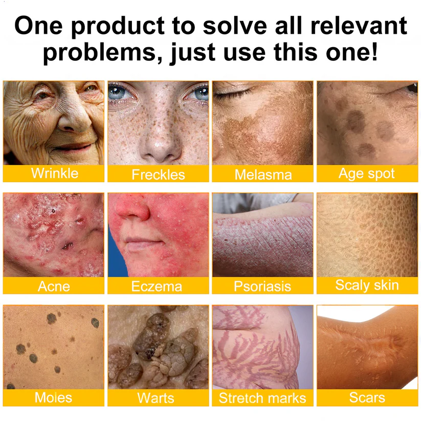 🌟Rolimey® Bee venom Pro Comprehensive Cream — 🔥Limited Time 80% OFF🔥