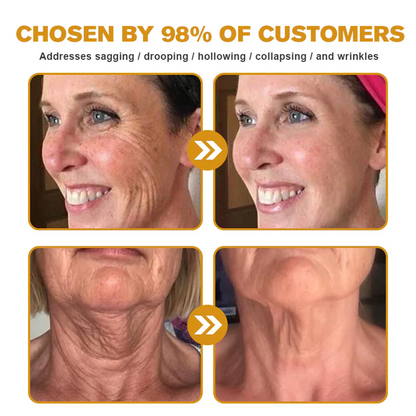 🌟Rolimey® Bee venom Pro Comprehensive Cream — 🔥Limited Time 80% OFF🔥