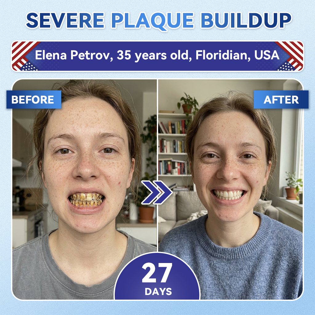Smile instantly 🦷 𝐺𝑙𝑖𝑚𝑚𝑒𝑟𝑙𝑦®⭐⭐ 𝑇𝑖𝑑𝑒𝑔𝑙𝑢𝑠𝑖𝑏 𝑇𝑜𝑜𝑡ℎ & 𝐺𝑢𝑚 𝑅𝑒𝑝𝑎𝑖𝑟 𝐹𝑎𝑠𝑡-𝐷𝑖𝑠𝑠𝑜𝑙𝑣𝑖𝑛𝑔 𝑊ℎ𝑖𝑡𝑒𝑛𝑖𝑛𝑔 𝑆𝑡𝑟𝑖𝑝𝑠  (𝟓-𝐢𝐧-𝟏 💎 𝐑𝐞𝐛𝐮𝐢𝐥𝐝 𝐄𝐧𝐚𝐦𝐞𝐥 & 𝐃𝐞𝐧𝐭𝐢𝐧 • 𝐒𝐭𝐫𝐞𝐧𝐠𝐭𝐡𝐞𝐧 𝐆𝐮𝐦𝐬 • 𝐄𝐫𝐚𝐝𝐢𝐜𝐚𝐭𝐞 𝐓𝐚𝐫𝐭𝐚𝐫 & 𝐎𝐝𝐨𝐫 • 𝐖𝐡𝐢𝐭𝐞𝐧𝐢𝐧𝐠 • 𝐒𝐭𝐨𝐩 𝐓𝐨𝐨𝐭𝐡 𝐒𝐞𝐧𝐬𝐢𝐭𝐢𝐯𝐢𝐭𝐲)