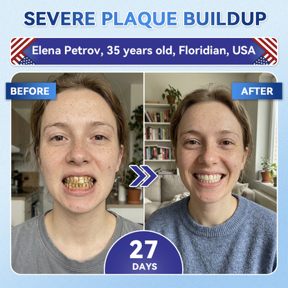 Smile instantly 🦷 𝐺𝑙𝑖𝑚𝑚𝑒𝑟𝑙𝑦®⭐⭐ 𝑇𝑖𝑑𝑒𝑔𝑙𝑢𝑠𝑖𝑏 𝑇𝑜𝑜𝑡ℎ & 𝐺𝑢𝑚 𝑅𝑒𝑝𝑎𝑖𝑟 𝐹𝑎𝑠𝑡-𝐷𝑖𝑠𝑠𝑜𝑙𝑣𝑖𝑛𝑔 𝑊ℎ𝑖𝑡𝑒𝑛𝑖𝑛𝑔 𝑆𝑡𝑟𝑖𝑝𝑠  (𝟓-𝐢𝐧-𝟏 💎 𝐑𝐞𝐛𝐮𝐢𝐥𝐝 𝐄𝐧𝐚𝐦𝐞𝐥 & 𝐃𝐞𝐧𝐭𝐢𝐧 • 𝐒𝐭𝐫𝐞𝐧𝐠𝐭𝐡𝐞𝐧 𝐆𝐮𝐦𝐬 • 𝐄𝐫𝐚𝐝𝐢𝐜𝐚𝐭𝐞 𝐓𝐚𝐫𝐭𝐚𝐫 & 𝐎𝐝𝐨𝐫 • 𝐖𝐡𝐢𝐭𝐞𝐧𝐢𝐧𝐠 • 𝐒𝐭𝐨𝐩 𝐓𝐨𝐨𝐭𝐡 𝐒𝐞𝐧𝐬𝐢𝐭𝐢𝐯𝐢𝐭𝐲)