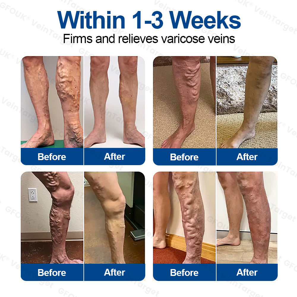 ✨8 boxes - Completely repair and strengthen blood vessels
