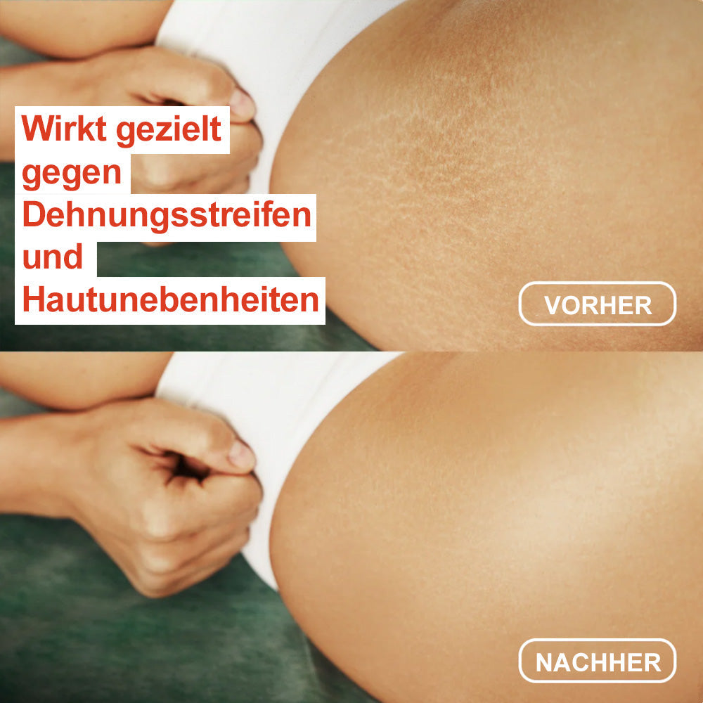 💐 Trilumia® Seiden-Körperöl 💕 Dermatest® geprüft – Strafft, glättet und festigt die Haut, reduziert Falten und stellt die jugendliche Elastizität wieder her.