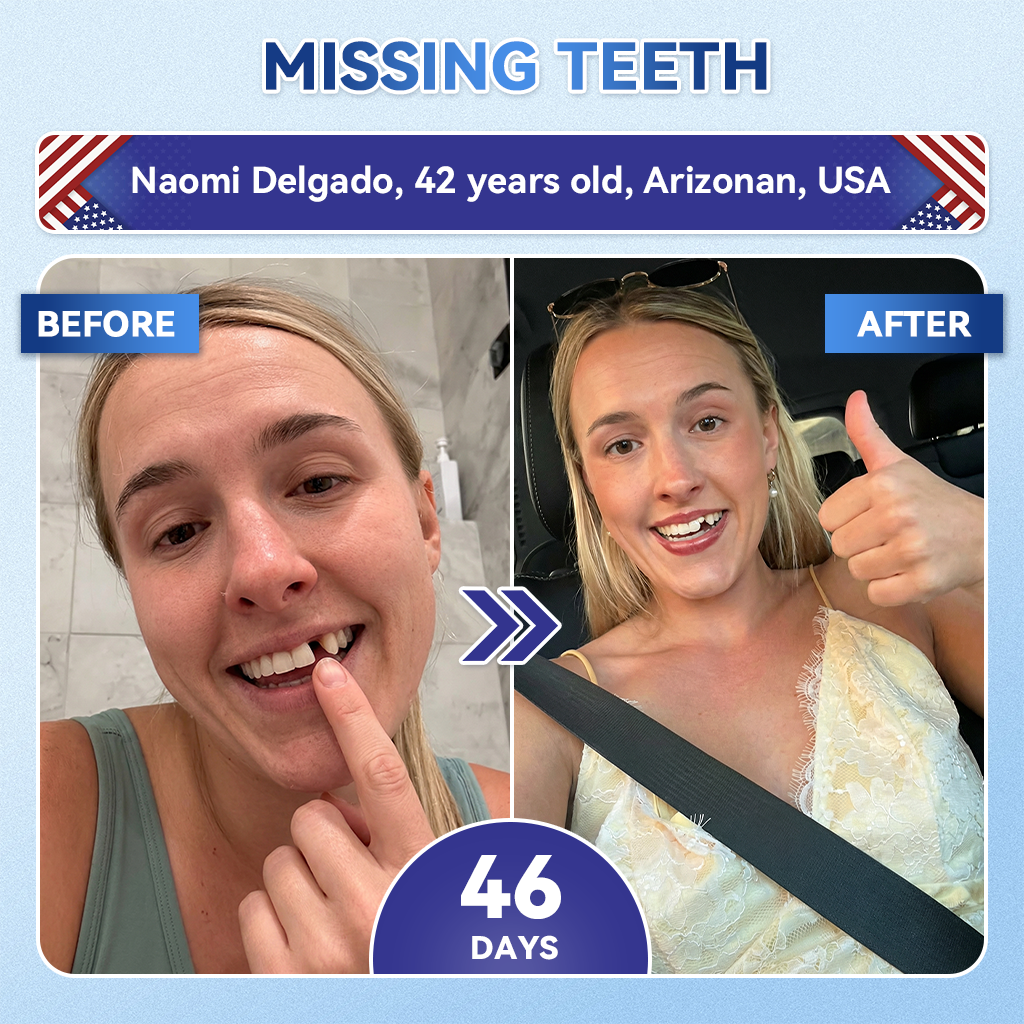 Smile instantly 🦷 𝐺𝑙𝑖𝑚𝑚𝑒𝑟𝑙𝑦®⭐⭐ 𝑇𝑖𝑑𝑒𝑔𝑙𝑢𝑠𝑖𝑏 𝑇𝑜𝑜𝑡ℎ & 𝐺𝑢𝑚 𝑅𝑒𝑝𝑎𝑖𝑟 𝐹𝑎𝑠𝑡-𝐷𝑖𝑠𝑠𝑜𝑙𝑣𝑖𝑛𝑔 𝑊ℎ𝑖𝑡𝑒𝑛𝑖𝑛𝑔 𝑆𝑡𝑟𝑖𝑝𝑠  (𝟓-𝐢𝐧-𝟏 💎 𝐑𝐞𝐛𝐮𝐢𝐥𝐝 𝐄𝐧𝐚𝐦𝐞𝐥 & 𝐃𝐞𝐧𝐭𝐢𝐧 • 𝐒𝐭𝐫𝐞𝐧𝐠𝐭𝐡𝐞𝐧 𝐆𝐮𝐦𝐬 • 𝐄𝐫𝐚𝐝𝐢𝐜𝐚𝐭𝐞 𝐓𝐚𝐫𝐭𝐚𝐫 & 𝐎𝐝𝐨𝐫 • 𝐖𝐡𝐢𝐭𝐞𝐧𝐢𝐧𝐠 • 𝐒𝐭𝐨𝐩 𝐓𝐨𝐨𝐭𝐡 𝐒𝐞𝐧𝐬𝐢𝐭𝐢𝐯𝐢𝐭𝐲)
