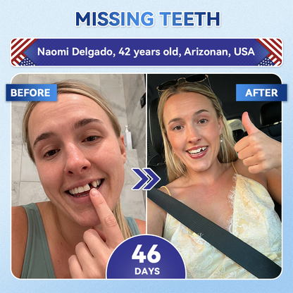 Smile instantly 🦷 𝐺𝑙𝑖𝑚𝑚𝑒𝑟𝑙𝑦®⭐⭐ 𝑇𝑖𝑑𝑒𝑔𝑙𝑢𝑠𝑖𝑏 𝑇𝑜𝑜𝑡ℎ & 𝐺𝑢𝑚 𝑅𝑒𝑝𝑎𝑖𝑟 𝐹𝑎𝑠𝑡-𝐷𝑖𝑠𝑠𝑜𝑙𝑣𝑖𝑛𝑔 𝑊ℎ𝑖𝑡𝑒𝑛𝑖𝑛𝑔 𝑆𝑡𝑟𝑖𝑝𝑠  (𝟓-𝐢𝐧-𝟏 💎 𝐑𝐞𝐛𝐮𝐢𝐥𝐝 𝐄𝐧𝐚𝐦𝐞𝐥 & 𝐃𝐞𝐧𝐭𝐢𝐧 • 𝐒𝐭𝐫𝐞𝐧𝐠𝐭𝐡𝐞𝐧 𝐆𝐮𝐦𝐬 • 𝐄𝐫𝐚𝐝𝐢𝐜𝐚𝐭𝐞 𝐓𝐚𝐫𝐭𝐚𝐫 & 𝐎𝐝𝐨𝐫 • 𝐖𝐡𝐢𝐭𝐞𝐧𝐢𝐧𝐠 • 𝐒𝐭𝐨𝐩 𝐓𝐨𝐨𝐭𝐡 𝐒𝐞𝐧𝐬𝐢𝐭𝐢𝐯𝐢𝐭𝐲)