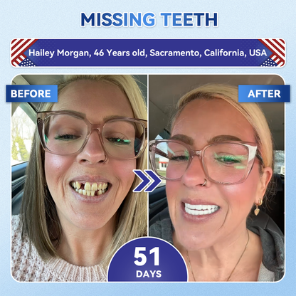 Smile instantly 🦷 𝐺𝑙𝑖𝑚𝑚𝑒𝑟𝑙𝑦®⭐⭐ 𝑇𝑖𝑑𝑒𝑔𝑙𝑢𝑠𝑖𝑏 𝑇𝑜𝑜𝑡ℎ & 𝐺𝑢𝑚 𝑅𝑒𝑝𝑎𝑖𝑟 𝐹𝑎𝑠𝑡-𝐷𝑖𝑠𝑠𝑜𝑙𝑣𝑖𝑛𝑔 𝑊ℎ𝑖𝑡𝑒𝑛𝑖𝑛𝑔 𝑆𝑡𝑟𝑖𝑝𝑠  (𝟓-𝐢𝐧-𝟏 💎 𝐑𝐞𝐛𝐮𝐢𝐥𝐝 𝐄𝐧𝐚𝐦𝐞𝐥 & 𝐃𝐞𝐧𝐭𝐢𝐧 • 𝐒𝐭𝐫𝐞𝐧𝐠𝐭𝐡𝐞𝐧 𝐆𝐮𝐦𝐬 • 𝐄𝐫𝐚𝐝𝐢𝐜𝐚𝐭𝐞 𝐓𝐚𝐫𝐭𝐚𝐫 & 𝐎𝐝𝐨𝐫 • 𝐖𝐡𝐢𝐭𝐞𝐧𝐢𝐧𝐠 • 𝐒𝐭𝐨𝐩 𝐓𝐨𝐨𝐭𝐡 𝐒𝐞𝐧𝐬𝐢𝐭𝐢𝐯𝐢𝐭𝐲)