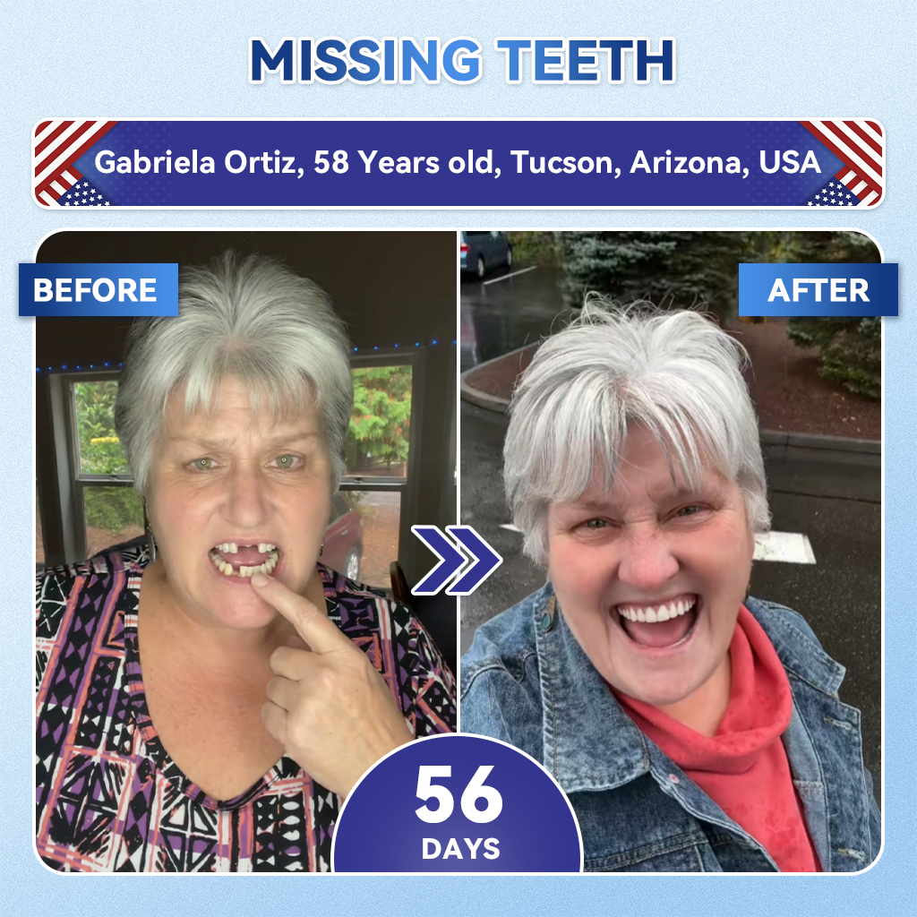 Smile instantly 🦷 𝐺𝑙𝑖𝑚𝑚𝑒𝑟𝑙𝑦®⭐⭐ 𝑇𝑖𝑑𝑒𝑔𝑙𝑢𝑠𝑖𝑏 𝑇𝑜𝑜𝑡ℎ & 𝐺𝑢𝑚 𝑅𝑒𝑝𝑎𝑖𝑟 𝐹𝑎𝑠𝑡-𝐷𝑖𝑠𝑠𝑜𝑙𝑣𝑖𝑛𝑔 𝑊ℎ𝑖𝑡𝑒𝑛𝑖𝑛𝑔 𝑆𝑡𝑟𝑖𝑝𝑠  (𝟓-𝐢𝐧-𝟏 💎 𝐑𝐞𝐛𝐮𝐢𝐥𝐝 𝐄𝐧𝐚𝐦𝐞𝐥 & 𝐃𝐞𝐧𝐭𝐢𝐧 • 𝐒𝐭𝐫𝐞𝐧𝐠𝐭𝐡𝐞𝐧 𝐆𝐮𝐦𝐬 • 𝐄𝐫𝐚𝐝𝐢𝐜𝐚𝐭𝐞 𝐓𝐚𝐫𝐭𝐚𝐫 & 𝐎𝐝𝐨𝐫 • 𝐖𝐡𝐢𝐭𝐞𝐧𝐢𝐧𝐠 • 𝐒𝐭𝐨𝐩 𝐓𝐨𝐨𝐭𝐡 𝐒𝐞𝐧𝐬𝐢𝐭𝐢𝐯𝐢𝐭𝐲)