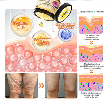 🌟Rolimey® Bee venom Pro Comprehensive Cream — 🔥Limited Time 80% OFF🔥
