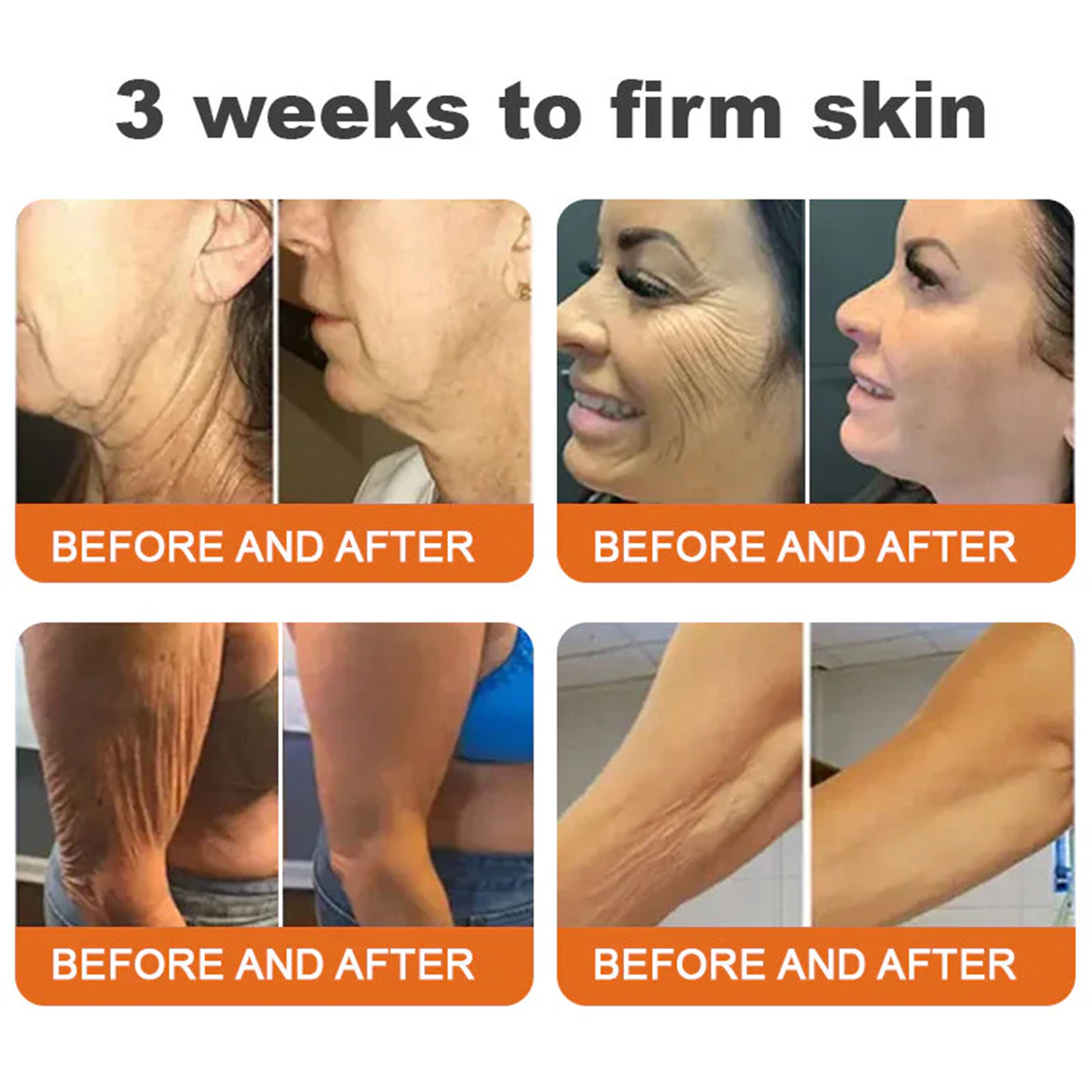 🌟Rolimey® Bee venom Pro Comprehensive Cream — 🔥Limited Time 80% OFF🔥
