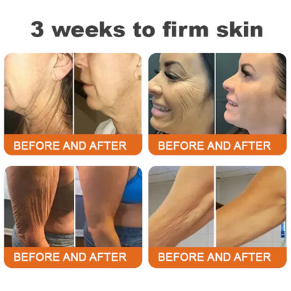 🌟Rolimey® Bee venom Pro Comprehensive Cream — 🔥Limited Time 80% OFF🔥