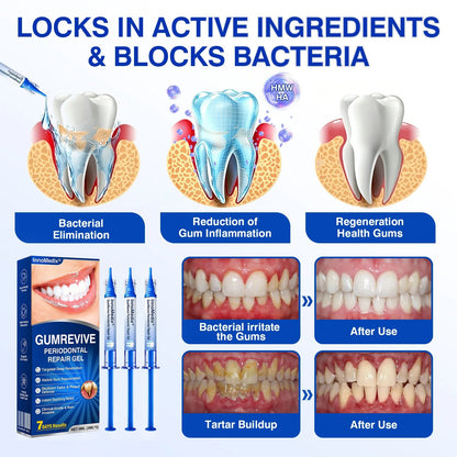 🇬🇧🏅🦷🛡️InnoMedix® GumRevive Periodontal Repair Gel