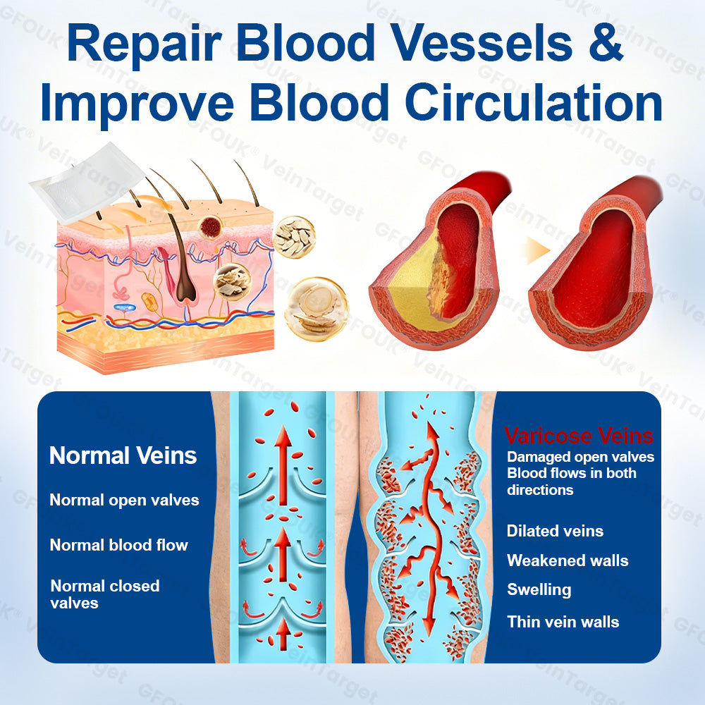 🔥4 boxes - Smooth out bulging hardened veins(One course of treatment)