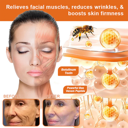 🌟Rolimey® Bee venom Pro Comprehensive Cream — 🔥Limited Time 80% OFF🔥